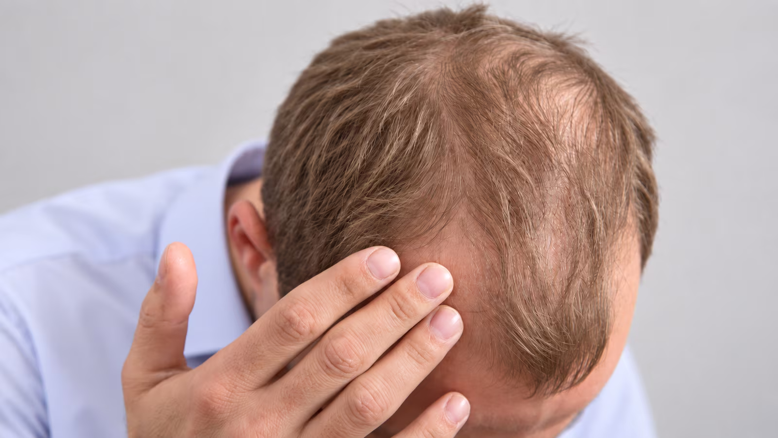 Thinning hair along the part