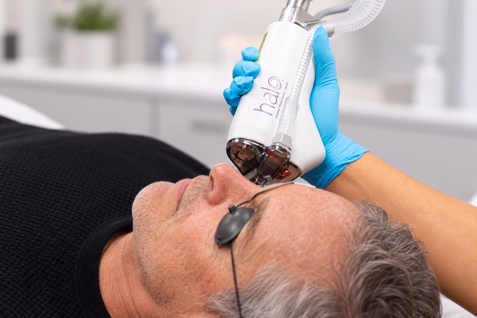HALO laser treatment
