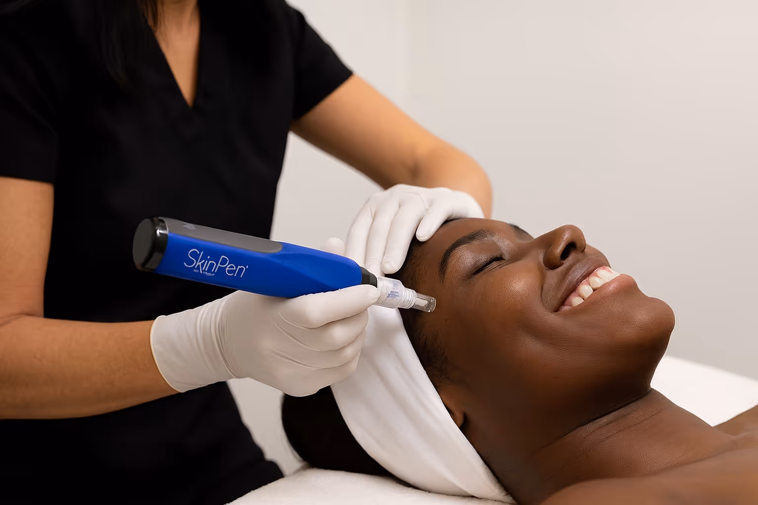 Microneedling SkinPen treatment